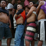 Kidney sellers showing their surgery scars, Quezon, Philippines.